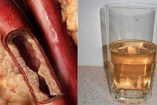 Как очистить артерии за месяц: напиток, который обеспечит сердцу надежную защиту.