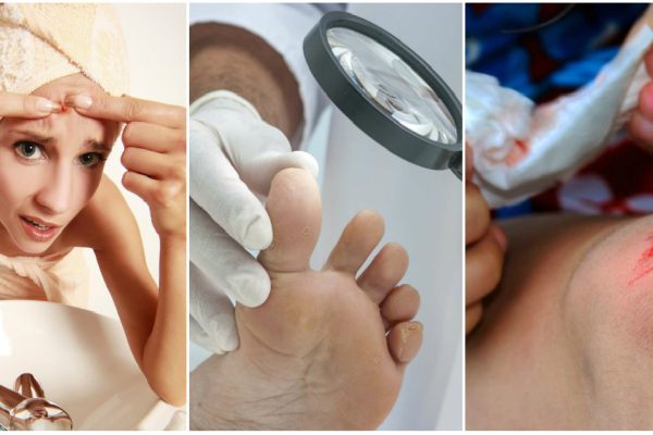 5 домашних рецептов для наружного применения мёда. Скорая помощь для кожи.