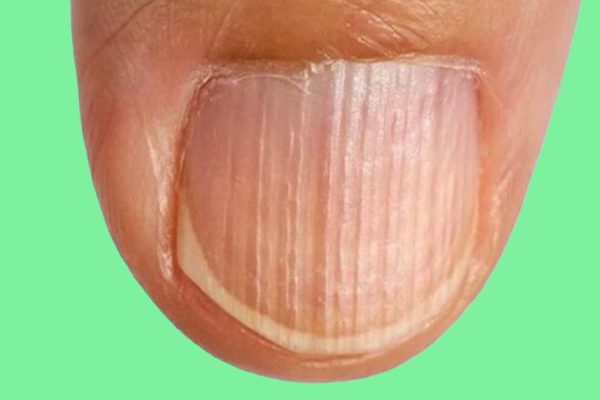 Эти 8 зловещих признаков намекают, что организм истощен! Дефицит белка…