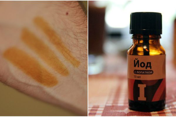 Вот что получится, если нанести немного йода на запястье!