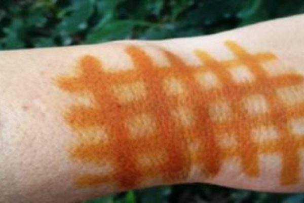 Оказывается, грудь можно увеличить при помощи обычного медицинского йода… Многие верят в это!