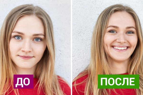 Вот они, самые модные пластические операции прошедшего года! Думала, меня уже ничем не удивишь…