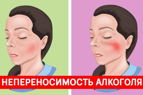 Непереносимость алкоголя реальна: осторожно, опасные последствия