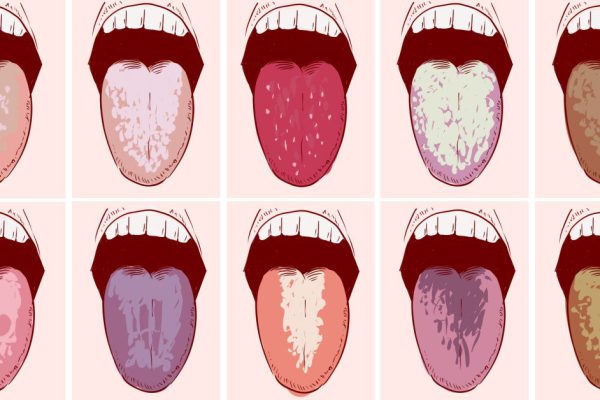 Если у тебя бывает неприятный привкус во рту по утрам, немедленно действуй!
