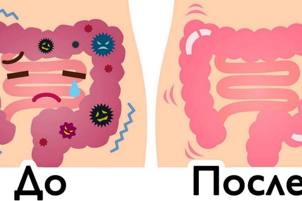Эта субстанция просто смоет всё лишнее! Кишечник полностью очищен.