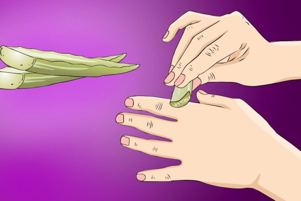 Первая помощь при бытовых ожогах