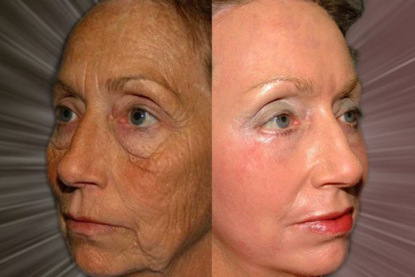 Женщина в свои 56 лет выглядит словно студентка! «Никакой хитрости нет, беру на ночь льняное…»