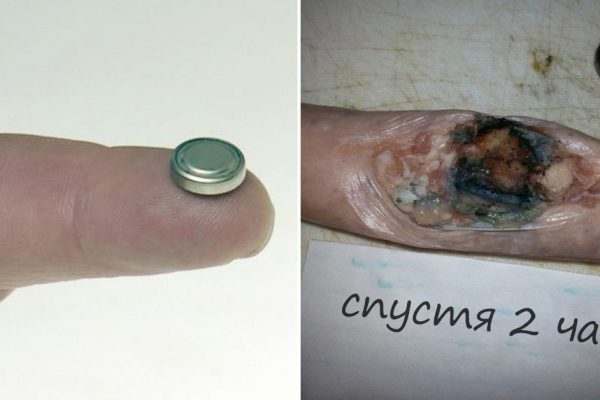 Мама этой маленькой девочки не знала, насколько опасна обычная игрушка…