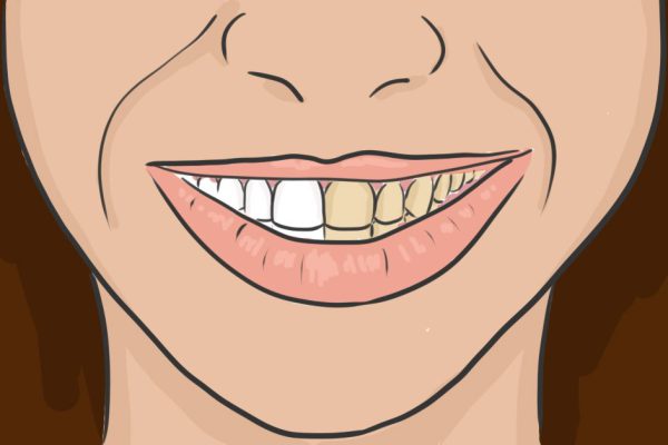 Делаю так перед чисткой зубов каждый раз! Забыла, как выглядит стоматолог…