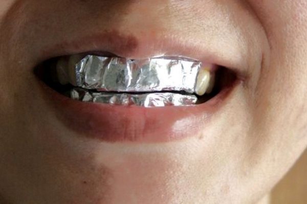 Она покрыла зубы пищевой фольгой с неожиданной целью… Результат впечатляет!