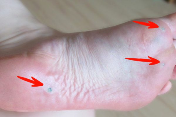 Многие и не догадываются, что переносят этот вирус! Вот она, причина страшных недугов…