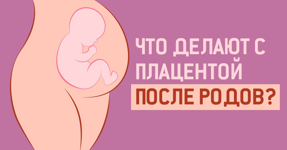 Дела после родов