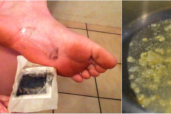 Стоило приложить это домашнее средство к стопам на всю ночь, чтобы наутро получить восхитительный результат!