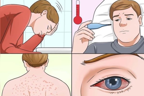 Осторожно — плесень! Эти признаки свидетельствуют о скрытой опасности в твоем доме…