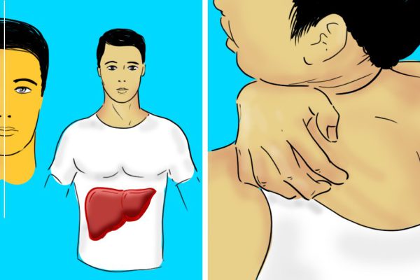 Неожиданные признаки заболеваний печени: 12 сигналов, которые помогут заподозрить неладное