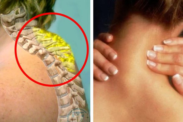 «Покажите мне, где болит спина, и я расскажу, какие у вас проблемы в жизни!» Частой причиной болезненных ощущений являются обычные…