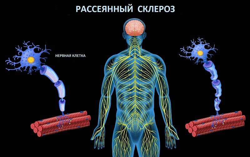почему дрожат руки когда голоден