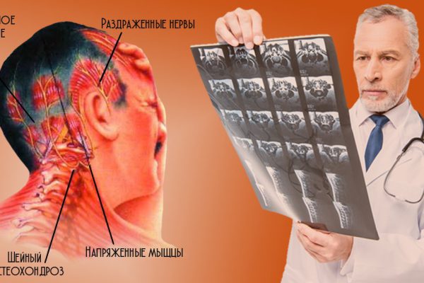 «Если болит голова и давит на глаза…» Почтенный специалист рассказал, почему болит голова и суставы «на погоду».