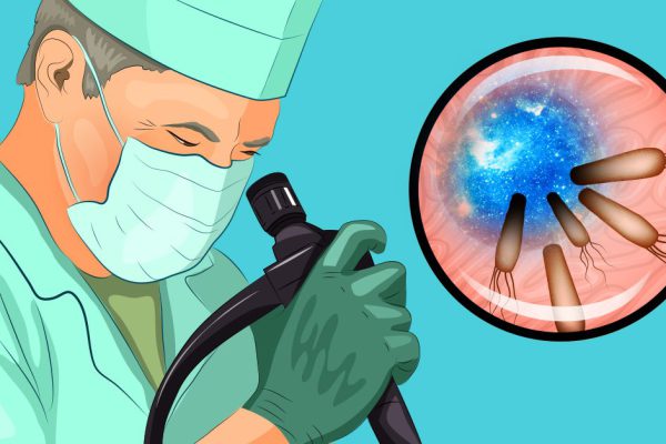 Гастроскопия — не самая приятная процедура, но всё решает правильная подготовка