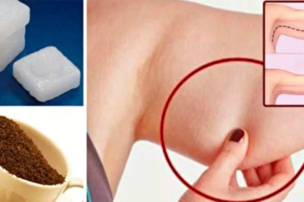 Морщинистая шея, дряблые руки и рыхлые бедра в прошлом! Это средство огорчит пластических хирургов.