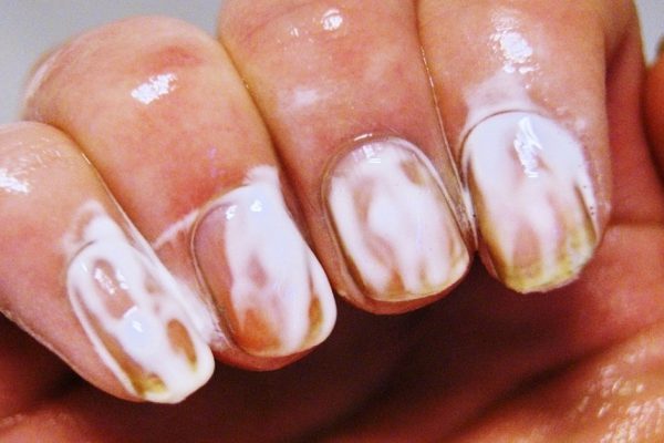 Оказывается, зубная паста решает многие проблемы! 10 полезностей.