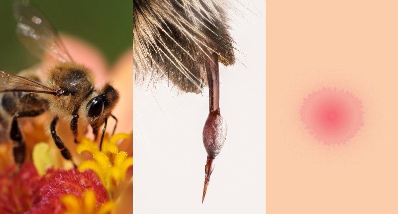Как узнать насекомое по укусу советы, безопасность, клещи, комары, насекомые, пауки, укусы