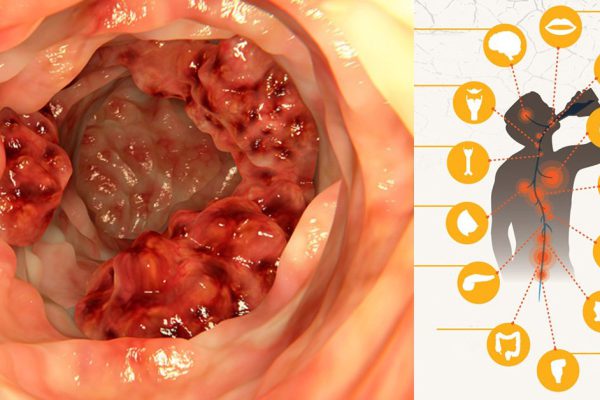5 опасных последствий употребления алкоголя. Многие даже не догадываются об этом!