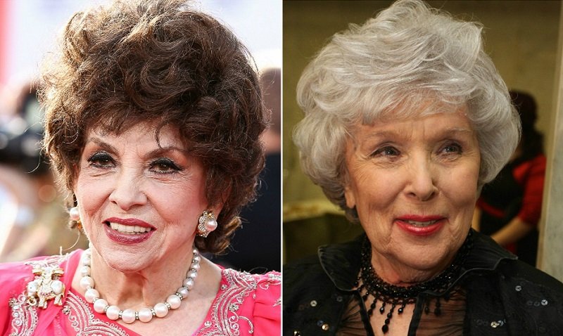 пластические операции звезд