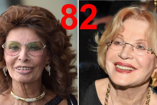 Пластические операции и уколы ботокса для славянской внешности: стареть или не стареть.