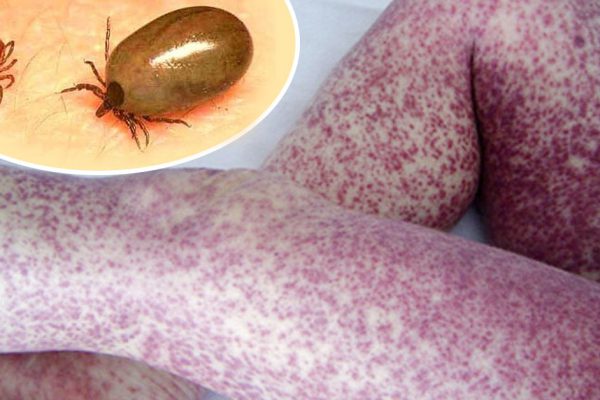 Если домашние животные любят спать в твоей постели, обрати внимание на это!