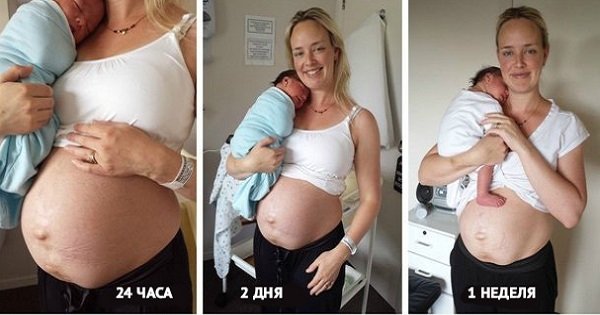 Вот как на самом деле выглядит тело женщины после родов. Шокирующие кадры!