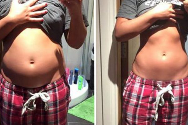 Эти снимки сделаны с разницей в 12 часов! Узнай, как сделать свой живот идеально плоским.