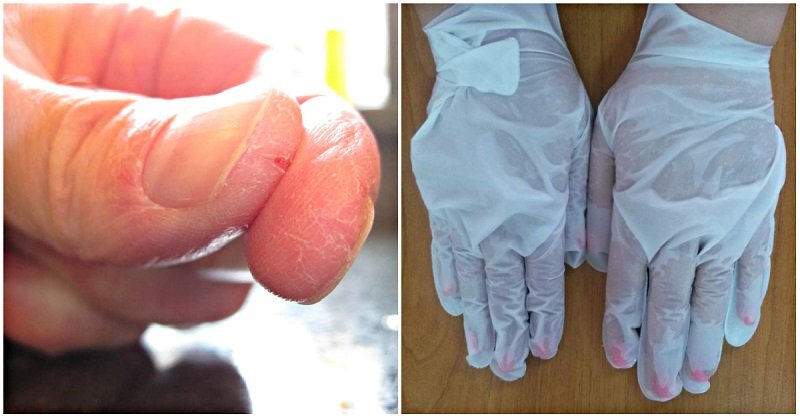 уход за кожей рук