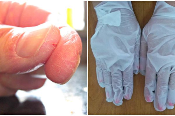 5 этапов правильного ухода за кожей рук. Секреты, о которых мало кто знает…