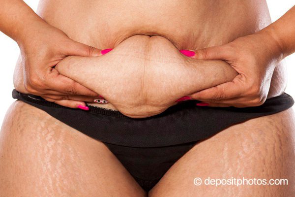 Могла ли я представить, что ЭТО поможет мне наконец похудеть и добиться результата! Не надеялась…