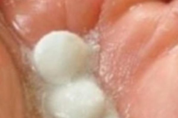 Она втирает «Парацетамол» в волосы. Это может показаться немного странным, но результат впечатляет!