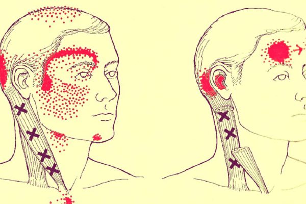 Нехватка всего 4 продуктов провоцирует головную боль. Если бы я знал об этом раньше!