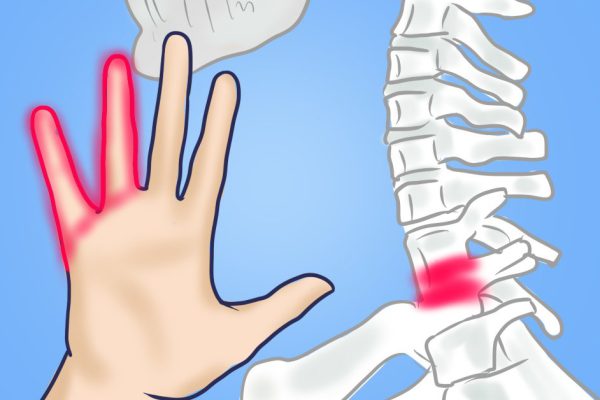 Почему немеют руки: 7 причин, заставляющих задуматься о здоровье.