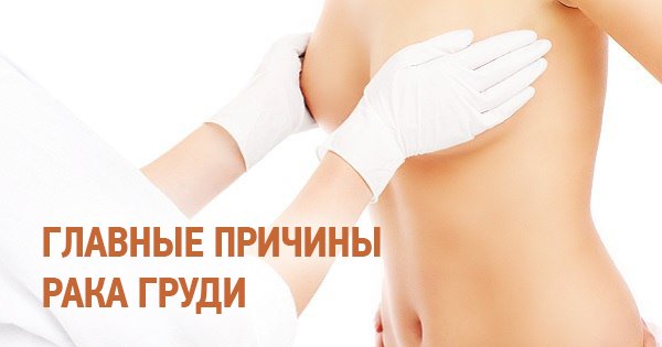 Причины возникновения рака груди, о которых ты не задумываешься. На это стоит обратить внимание!