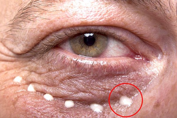 8 сигналов, при помощи которых глаза предупреждают о проблемах со здоровьем! Обрати внимание!