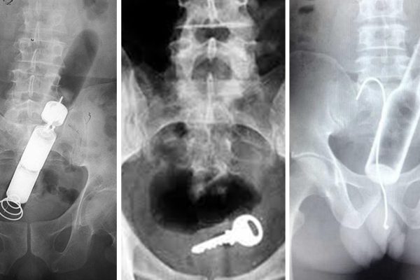 Знакомый гастроэнтеролог посвятил в секреты профессии. Ну и случаи бывают!