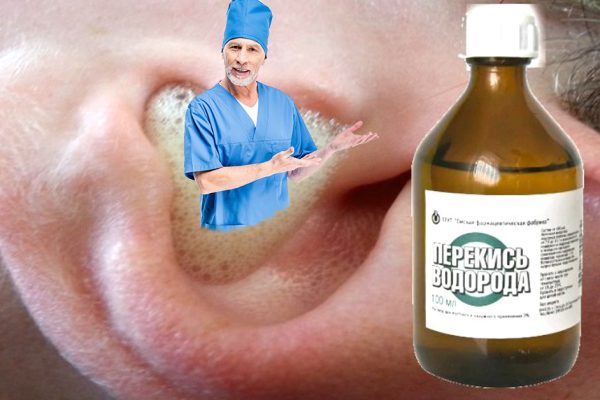 Весьма нестандартные способы! Вердикт врача: «Перекись водорода способна на большее…»