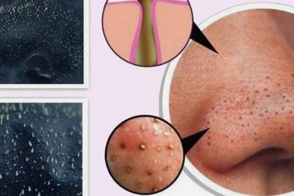 6 областей применения желатина, о которых многие даже не подозревают.