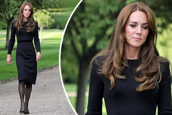 Косметологи попрекают Кейт Миддлтон за преждевременное старение