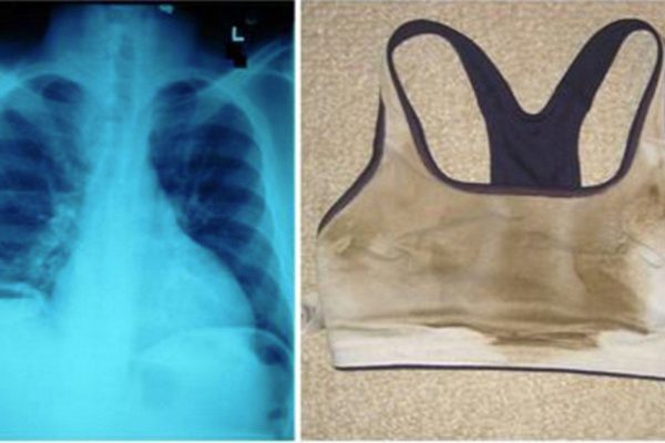 9 вредных вещей, которые давно вошли в привычку. Хватит разрушать свой организм!