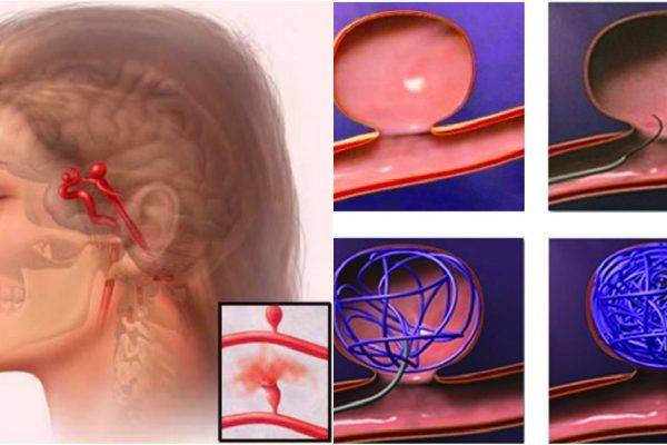 Миллионы людей живут, не подозревая о смертельной болезни! Узнай, как распознать и выжить.