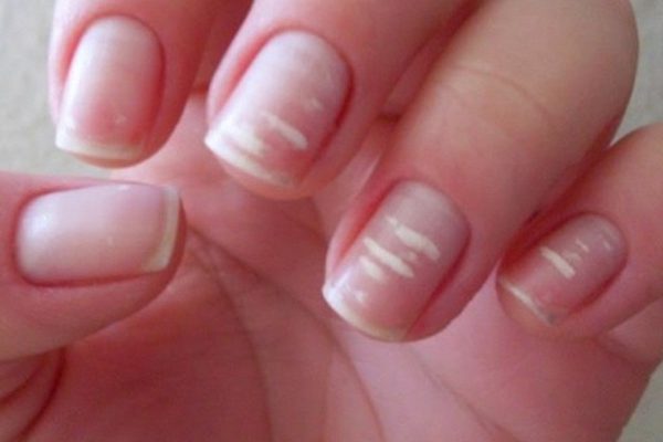 9 поводов для немедленного реагирования! Эти признаки указывают на явную нехватку витаминов.