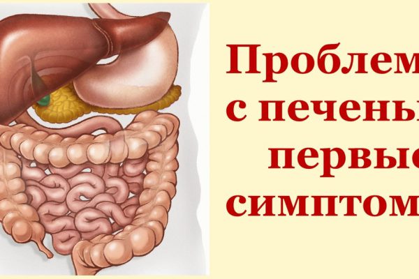 10 тревожных симптомов того, что печень не в порядке: будь начеку!