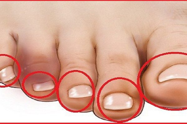 Первый признак болезни сердца: для начала коснись пальцев на ногах…