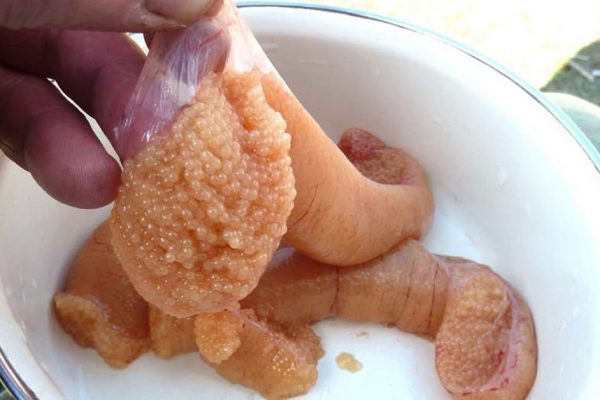 Вот что может быть причиной неприятного запаха изо рта! Если жвачка не дает должного эффекта…